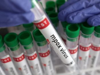 Πρώτο κρούσμα ευλογιάς των πιθήκων στην Ήπειρο