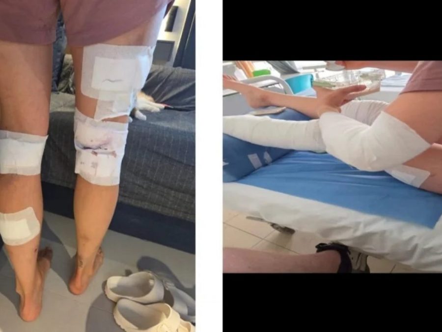 Ολλανδή τραυματίστηκε σοβαρά μετά από επίθεση αδέσποτων σκύλων 