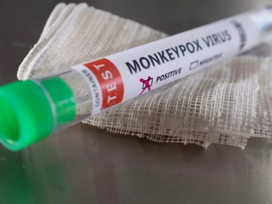 Ιωάννινα: Στη ΜΕΛ του ΠΓΝΙ ασθενής με mpox – Ιχνηλάτηση επαφών από τον ΕΟΔΥ