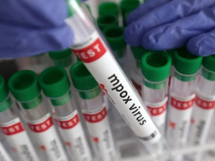 Πρώτο κρούσμα ευλογιάς των πιθήκων στην Ήπειρο